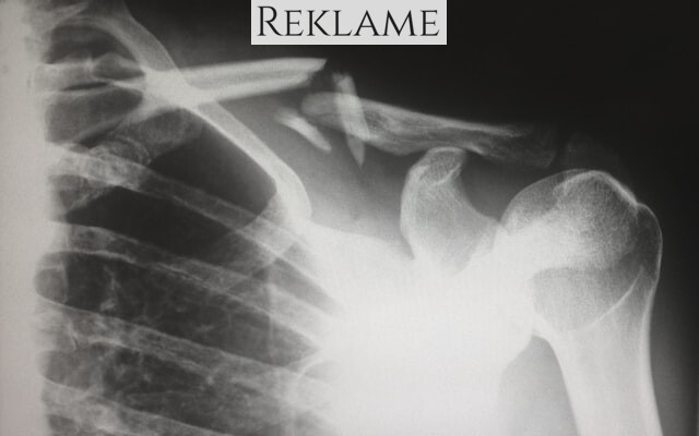 Sådan anvendes X-ray i dag